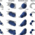 模拟多丸递送到不同大脑结构(纹状体、杏仁核、黑质和海马)的3D效果图